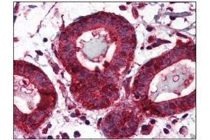 Immunohistochemistry (IHC) image for anti-Heat Shock Protein 90kDa beta (Grp94), Member 1 (HSP90B1) (AA 676-803) antibody (ABIN317570)