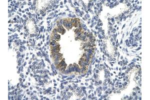 Rabbit Anti-TP53 antibody Catalog Number: AVARP02055  Paraffin Embedded Tissue: Human Lung cell Cellular Data: bronchiole epithelium of renal tubule Antibody Concentration: 4. (p53 anticorps  (C-Term))