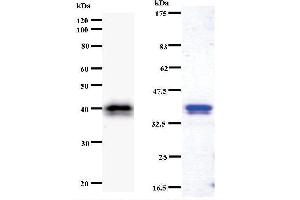 Left: CHD1L staining. (CHD1L anticorps)