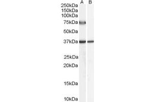 Western Blotting (WB) image for anti-Acyl-CoA Oxidase 2, Branched Chain (Acox2) (AA 651-664) antibody (ABIN291240) (Acox2 anticorps  (AA 651-664))