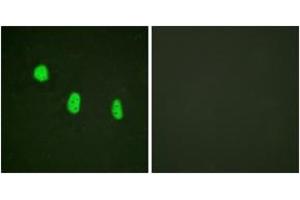 Immunofluorescence analysis of HeLa cells, using C/EBP-epsilon (Phospho-Thr74) Antibody. (CEBPE anticorps  (pThr74))