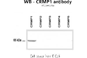 Image no. 2 for anti-GABA Transporter 1 (GAT1) (C-Term) antibody (ABIN346940) (SLC6A1 anticorps  (C-Term))