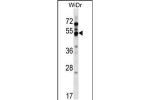 Western blot analysis in WiDr cell line lysates (35ug/lane). (GPR84 anticorps  (AA 265-293))