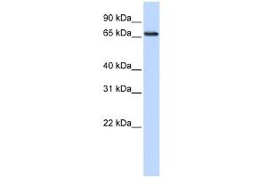 WB Suggested Anti-WDSOF1 Antibody Titration: 0. (DCAF13 anticorps  (N-Term))