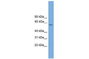 WB Suggested Anti-ZBTB46 Antibody Titration:  0. (ZBTB46 anticorps  (Middle Region))