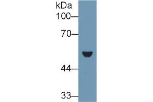 Detection of CK7 in Rat Lung lysate using Polyclonal Antibody to Cytokeratin 7 (CK7)