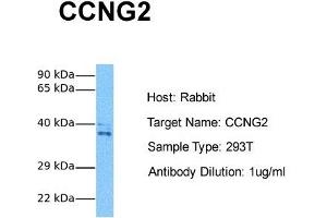 Host: Rabbit Target Name: CCNG2 Sample Tissue: Human 293T Antibody Dilution: 1.