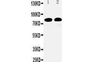 Anti-Calpain 1 antibody, Western blotting Lane 1:  Cell Lysate Lane 2: COLO320 Cell Lysate (CAPNL1 anticorps  (Middle Region))