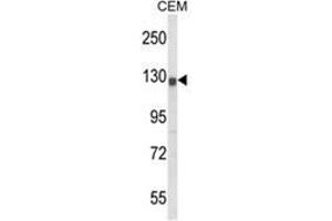 Western blot analysis of KCNH2 Antibody (Center) in CEM cell line lysates (35ug/lane). (KCNH2 anticorps  (Middle Region))