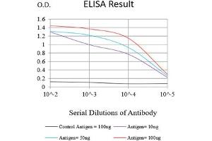 Black line: Control Antigen (100 ng),Purple line: Antigen (10 ng), Blue line: Antigen (50 ng), Red line:Antigen (100 ng)