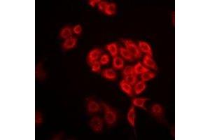 Immunofluorescent analysis of DHRS9 staining in Hela cells. (DHRS9 anticorps)
