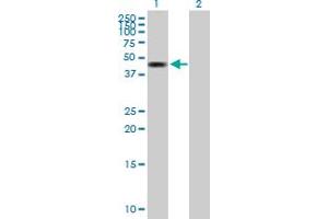 Western Blot analysis of ZMYND10 expression in transfected 293T cell line by ZMYND10 MaxPab polyclonal antibody. (ZMYND10 anticorps  (AA 1-440))