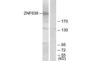 Western blot analysis of extracts from HepG2 cells, treated with serum (20%, 15mins), using ZNF638 antibody. (ZNF638 anticorps  (Internal Region))
