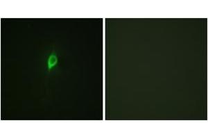 Immunofluorescence analysis of NIH-3T3 cells, using eIF4B (Phospho-Ser422) Antibody. (EIF4B anticorps  (pSer422))