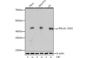 Western blot analysis of extracts of various cell lines, using Phospho-PDH-S293 Rabbit mAb (ABIN7269768) at 1:1000 dilution.