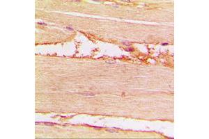 Immunohistochemical analysis of Merlin (pS518) staining in human muscle formalin fixed paraffin embedded tissue section. (Merlin anticorps  (C-Term, pSer518))