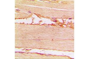Immunohistochemical analysis of Merlin (pS518) staining in human muscle formalin fixed paraffin embedded tissue section.