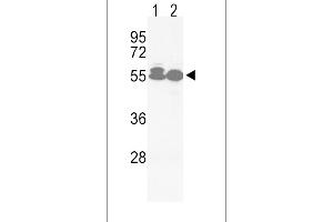 Western blot analysis of hACVRL1-L489 in Jurkat(lane 1), HepG2(lane 2) cell line lysates (35ug/lane) (ACVRL1 anticorps  (C-Term))