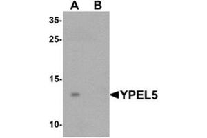 Western blot analysis of YPEL5 in A-20 cell lysate with YPEL5 Antibody  at 1 ug/mL in (A) the absence and (B) the presence of blocking peptide. (YPEL5 anticorps  (N-Term))