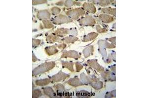 ZMYND17 Antibody (C-term) immunohistochemistry analysis in formalin fixed and paraffin embedded human skeletal muscle followed by peroxidase conjugation of the secondary antibody and DAB staining. (ZMYND17 anticorps  (C-Term))