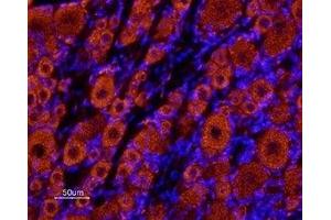 Expression of KCNK18 in rat dorsal root ganglia - Immunohistochemical staining of rat dorsal root ganglia (DRG) frozen sections using Anti-KCNK18 (TRESK) (extracellular) Antibody (ABIN7043446, ABIN7045021 and ABIN7045022), (1:100) followed by Alexa 555-labeled secondary antibody (red staining). (KCNK18 anticorps  (Extracellular))