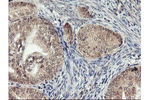 Image no. 2 for anti-1-Acylglycerol-3-Phosphate O-Acyltransferase 5 (Lysophosphatidic Acid Acyltransferase, Epsilon) (AGPAT5) antibody (ABIN1496498)