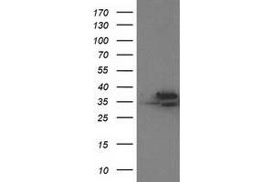 Western Blotting (WB) image for anti-Cyclin-Dependent Kinase 2 (CDK2) antibody (ABIN1497394)