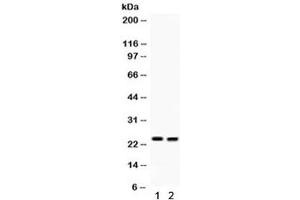 Western blot testing of 1) mouse lung and 2) mouse intestine lysate with LCN2 antibody. (Lipocalin 2 anticorps  (AA 21-198))