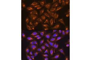 Immunofluorescence analysis of U2OS cells using SDHB Rabbit pAb (ABIN6131588, ABIN6147472, ABIN6147474 and ABIN6215002) at dilution of 1:100.