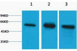 Western Blotting (WB) image for anti-Tubulin, beta (TUBB) antibody (ABIN3178782) (TUBB anticorps)