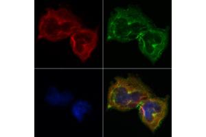 ABIN6264016 and ABIN6268722 staining Hela by IF/ICC. (SERPINB2 anticorps  (Internal Region))