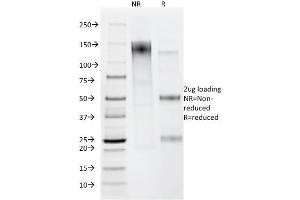 SDS-PAGE Analysis Purified Helicobacter pylori Mouse Monoclonal Antibody (HP/212). (Helicobacter Pylori anticorps)