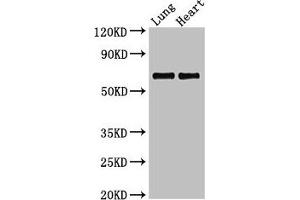 Western Blot Positive WB detected in: Rat lung tissue, Rat heart tissue All lanes: POLL antibody at 2. (POLL anticorps  (AA 16-211))