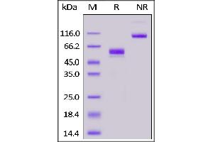 Mouse CD3E&CD3D Heterodimer Protein, Fc,His Tag&Fc,Flag Tag on  under reducing (R) and ing (NR) conditions.