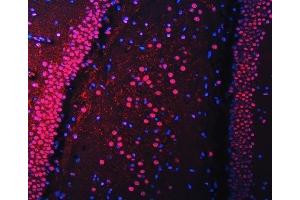 IF analysis of RBM22 using anti-RBM22 antibody (ABIN7600268). (RBM22 anticorps  (AA 17-406))