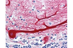 Anti-WNT10B antibody IHC of human brain, cerebellum.