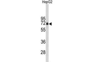 Western Blotting (WB) image for anti-F-Box Protein 3 (FBXO3) antibody (ABIN3004076) (F-Box Protein 3 anticorps)