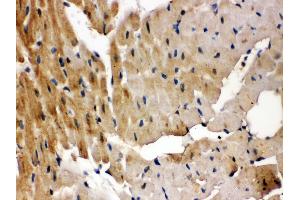 Anti- GRK5 Picoband antibody,IHC(P) IHC(P): Rat Cardiac Muscle Tissue