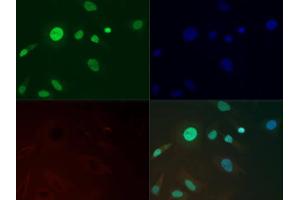 Immunofluorescence of Anti-Histone H3 K36 me3: Histone H3 Me3 Lys36 antibody was tested at 1:500 in HeLa cells with FITC (green).
