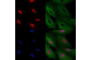 ABIN6259555 and ABIN6275395 staining  cells by IF/ICC. (SLU7 anticorps  (Internal Region))