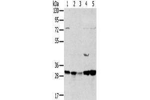 Western Blotting (WB) image for anti-Tumor Protein D52-Like 2 (TPD52L2) antibody (ABIN2434039) (TPD52L2 anticorps)