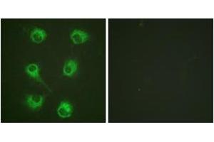 Immunofluorescence analysis of HuvEc cells, using CrkL (Ab-207) Antibody. (CrkL anticorps  (AA 173-222))