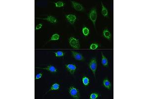 Immunofluorescence analysis of L929 cells using LARS Rabbit pAb (ABIN7268238) at dilution of 1:100.