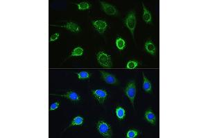 Immunofluorescence analysis of L929 cells using LARS Rabbit pAb (ABIN7268238) at dilution of 1:100. (LARS anticorps  (AA 1-270))