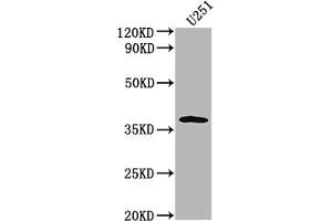 Western Blot Positive WB detected in: U251 whole cell lysate All lanes: OR6B3 antibody at 1:2000 Secondary Goat polyclonal to rabbit IgG at 1/50000 dilution Predicted band size: 38 kDa Observed band size: 38 kDa