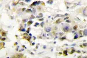 Image no. 2 for anti-Mediator Complex Subunit 1 (MED1) antibody (ABIN272236) (MED1 anticorps)