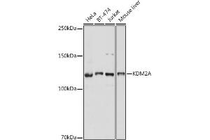 Western blot analysis of extracts of various cell lines, using KDM2A antibody (ABIN7268326) at 1:1000 dilution. (KDM2A anticorps)