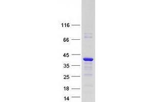 Validation with Western Blot