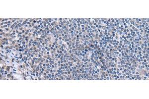 Immunohistochemistry of paraffin-embedded Human tonsil tissue using CCK Polyclonal Antibody at dilution of 1:55. (Cholecystokinin anticorps)