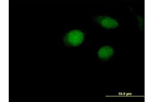 Immunofluorescence of purified MaxPab antibody to ARL4A on HeLa cell. (ARL4A anticorps  (AA 1-200))
